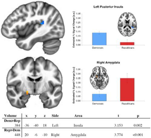 PLoS ONE 8(2):Red Brain, Blue Brain